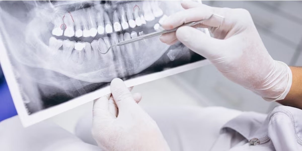 عکس برداری از دندان